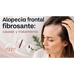 Alopecia frontal fibrosante: causas y tratamiento