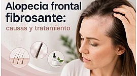 Alopecia frontal fibrosante: causas y tratamiento