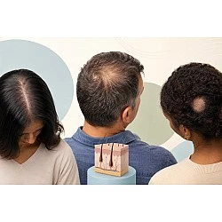 Tipos de alopecia y caída del cabello: guía general