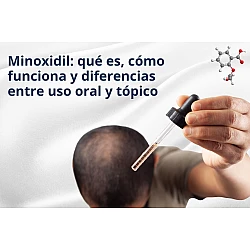 Minoxidil: qué es, cómo funciona y diferencias entre uso oral y tópico