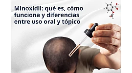 Minoxidil: qué es, cómo funciona y diferencias entre uso oral y tópico