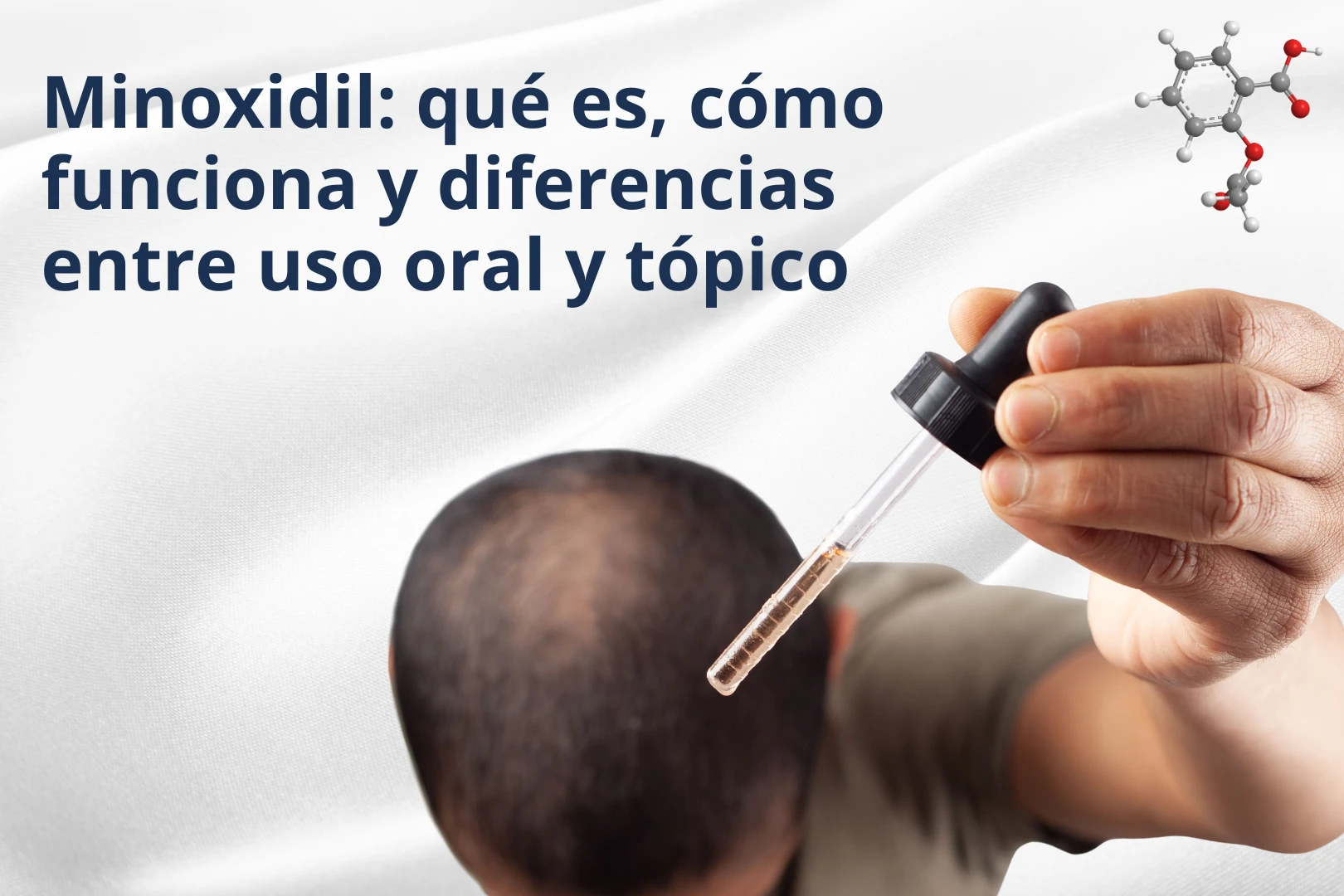 Minoxidil: qué es y diferencia entre uso oral y tópico